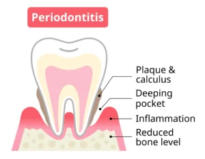 periodontist